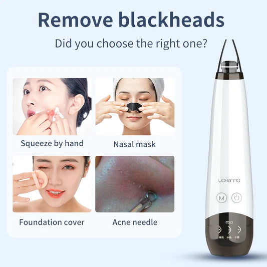 Blackhead Remover Vacuum Acne Pimple Black Spot Suction Electric Facial Pore Cleaner Skincare Exfoliating Beauty Device